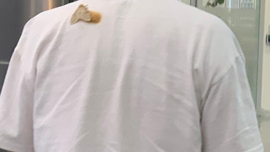 "나방이 옷에 붙어 알을 낳았다" 충격적인 해프닝