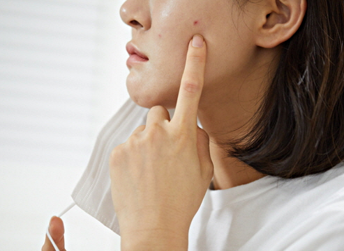 마스크로 인한 트러블, 예방하는 방법은?
